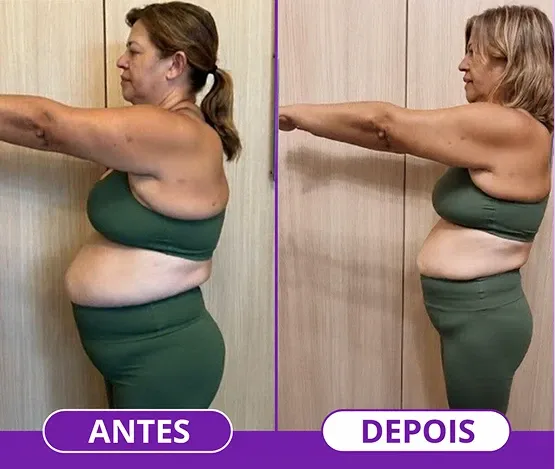 Antes e depois de aluna do programa